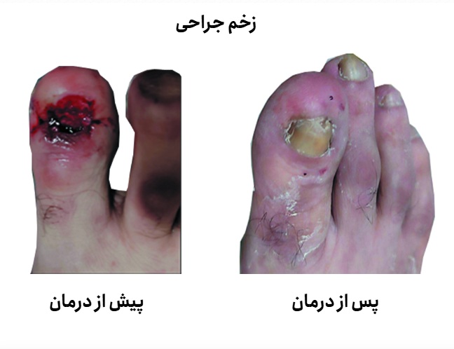 جراحی